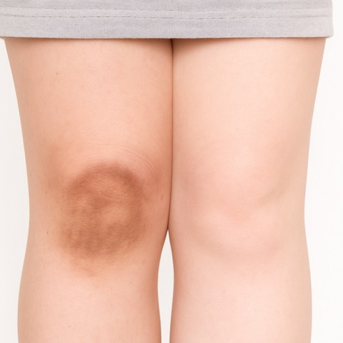 숨기고 싶은 고민, 이제 안녕! [NEW 삼색 벚꽃] 미백 크림으로 자신감을 되찾으세요.