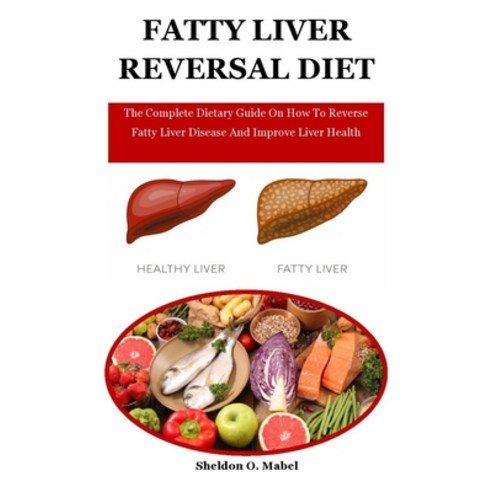Fatty Liver Reversal Diet: The Complete Dietary Guide On How To Reverse Fatty Liver Disease And Impr... Paperback, Independently Published, English, 9798724910767