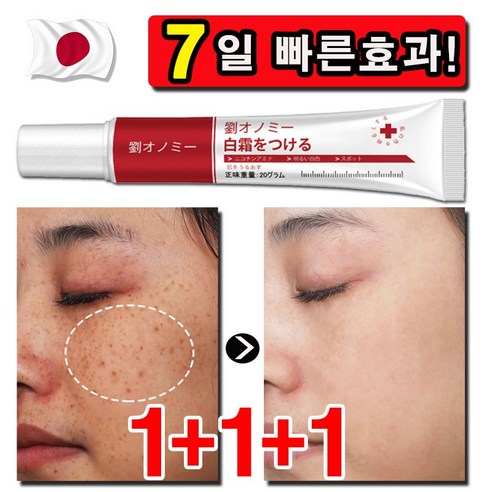 [일본기술] 기미 크림 잡티 주근깨 검버섯 제거 멜라토닝 색소침착 미백 화이트닝 케어 기능성 크림 임상실험완료 피부톤보정, 2개, 20g