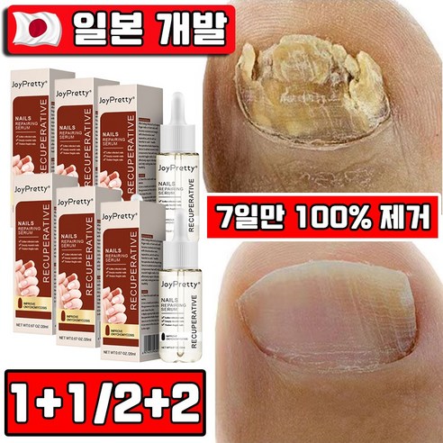 7일 만에 되찾는 건강한 손발톱, 놀라운 변화를 경험하세요 발톱무좀약