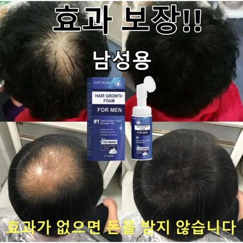 탈모, 이제는 두려워 말고 두피 케어로 당당하게!