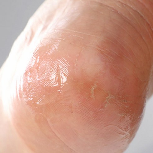 건조하고 거친 피부를 진정하고 수분을 공급하는 카밀렌60 슈르덴크림