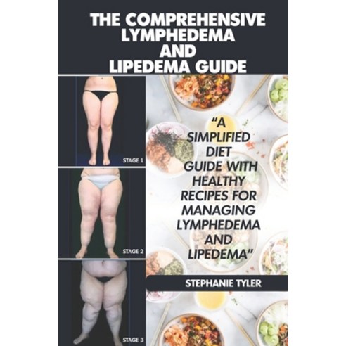 (영문도서) The Comprehensive Lymphedema and Lipedema Guide: The Comprehensive Lymphedema and Lipedema Guide Paperback, Independently Published, English, 9798844297168