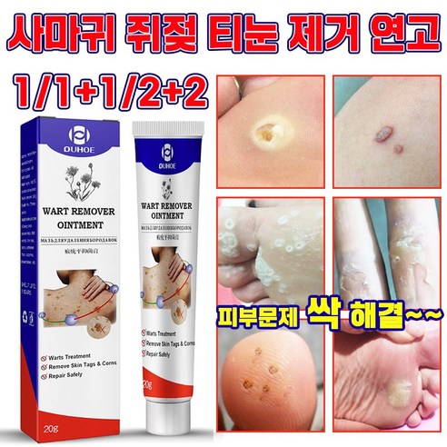 [국내배송] 제거 연고 제거제 얼굴 점빼기 피부 치료 크림 포장증정, 1개, 20g