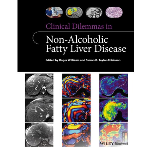 (영문도서) Clinical Dilemmas in Non-Alcoholic Fatty Liver Disease Paperback, Wiley-Blackwell, English, 9781118912034
