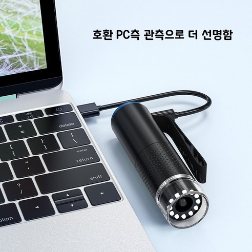 Qzero 두피진단기 - 두피 카메라로 모발 검사하고 두피 상태 확인하기