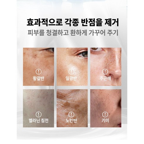 피부 반점 문제의 궁극적인 해결책