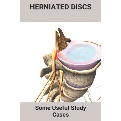 Herniated Discs: Some Useful Study Cases: Herniated Discs In Lower Back Paperback, Independently Published, English, 9798731437820