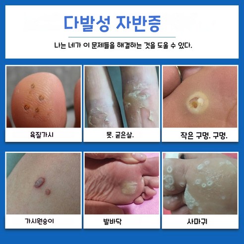 편안한 발 건강을 위한 필수 아이템