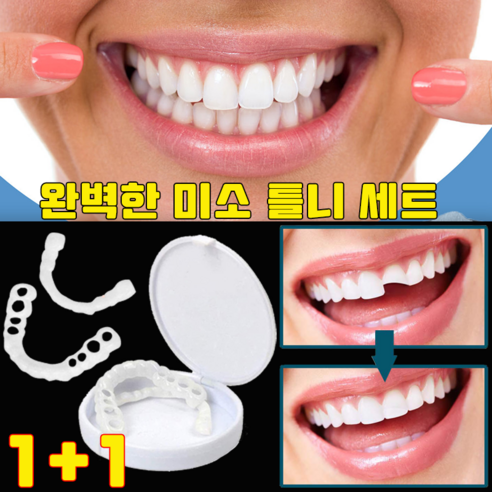 잃어버린 미소를 되찾아줄 희망, 임시 틀니 세트 완벽 분석 틀니