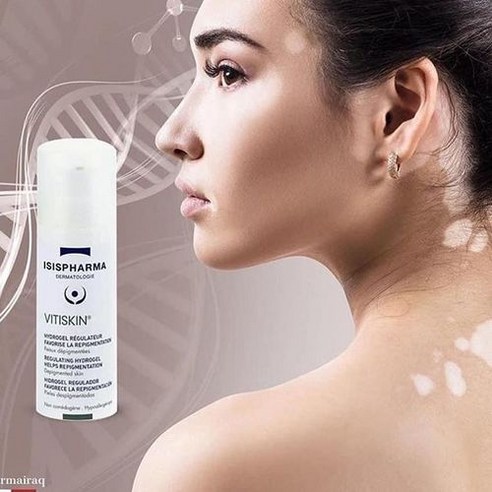 이시스파마 비티스킨 50ml – 백반증 완화 크림 1개 엑시머레이저 이시스파마 비티스킨 50ml – 백반증 완화 크림 1개 엑시머레이저