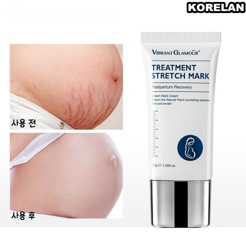 KORELAN 1 1튼살크림 케어 스트레치 마크 크림 뱃살크림