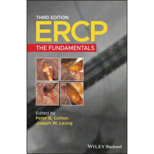 Ercp: The Fundamentals Hardcover, Wiley-Blackwell
