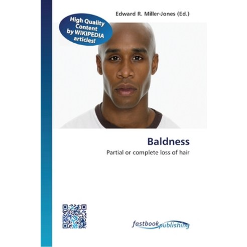 Baldness Paperback, Fastbook Publishing