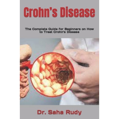 (영문도서) Crohn''s Disease: The Complete Guide for Beginners on How to Treat Crohn''s Disease Paperback, Independently Published, English, 9798495455658