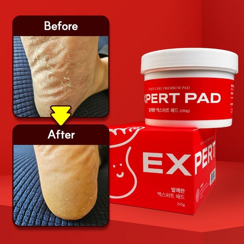 발쾌한 엑스퍼트 패드: 발과 피부의 완벽한 관리 비법 발바닥무좀약