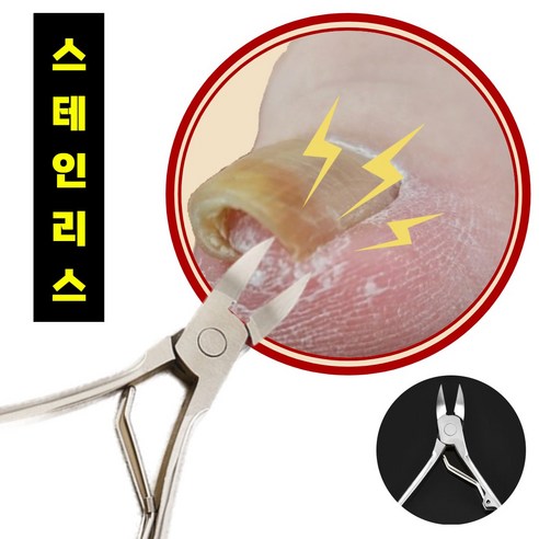 풋풋샵 사각지대 내성발톱깎이, 1개