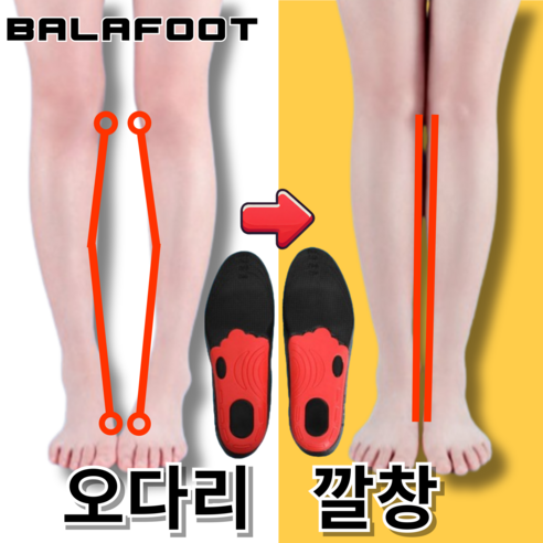 발아풋 오다리 깔창 교정 팔자걸음 휜다리 자세교정, 1개