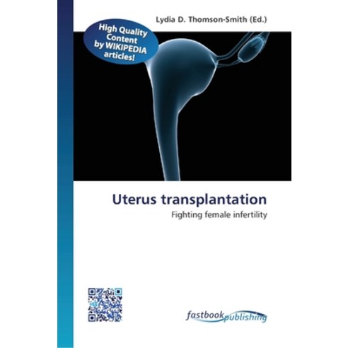 Uterus transplantation Paperback, Fastbook Publishing