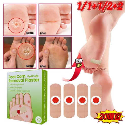 발바닥의 고통으로부터의 해방: 티눈 제거 밴드, 풋케어의 새로운 지평을 열다 티눈약