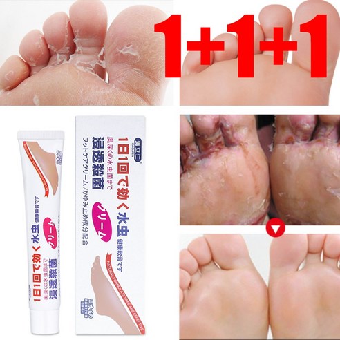 [일본식 포뮬러]무좀 크림 가려움 방지 발냄새 족부진균 억제 탈피, 20g, 2개