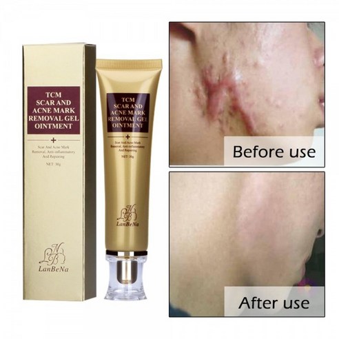 Acne Scar Removal Cream Stretch Marks Face Skin Repair Cream Shrink Pores Gel-Fa, 1개 재생크림 Best Top5