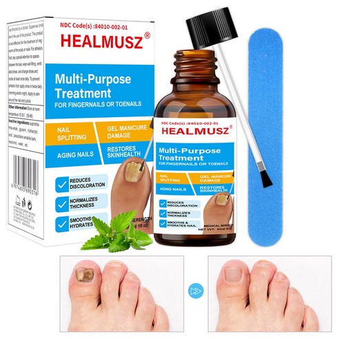 HEALMUSZ 발톱진균 발톱무좀 곰팡이 억제 네일 에센스 문제성발톱 솔루션, 2개, 30ml