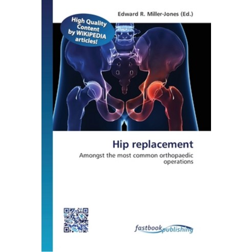 Hip replacement Paperback, Fastbook Publishing