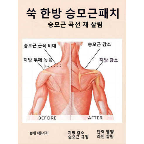 [전문관리]1/1+1 승모 승모근 패치 셀룰라이트 감소 패치 12pcs, 2개, 12매입