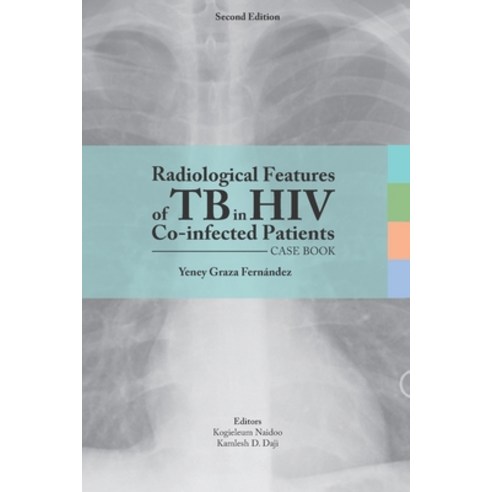 (영문도서) Radiological features of TB in HIV Co-infected Patients. Case book Paperback, Independently Published, English, 9798559524511
