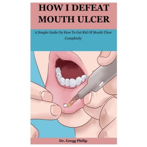 How I Defeat Mouth Ulcer: A Simple Guide On How To Get Rid Of Mouth Ulcer Completely Paperback, Independently Published