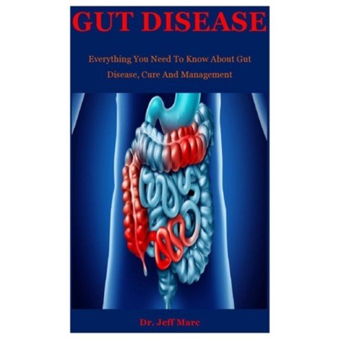 Gut Disease: Everything You Need To Know About Gut Disease Cure And Management Paperback, Independently Published