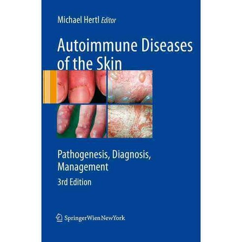Autoimmune Diseases of the Skin: Pathogenesis Diagnosis Management ...