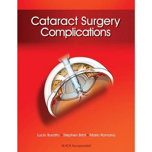 Cataract Surgery Complications Hardcover, Slack