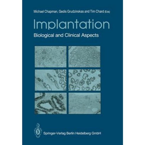 Implantation: Biological and Clinical Aspects Paperback, Springer