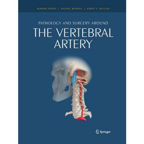 Pathology and Surgery Around the Vertebral Artery Paperback, Springer