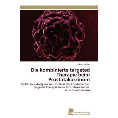 Die Kombinierte Targeted Therapie Beim Prostatakarzinom Paperback, Sudwestdeutscher Verlag Fur Hochschulschrifte