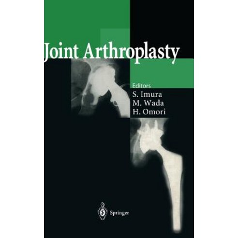 Joint Arthroplasty Hardcover, Springer