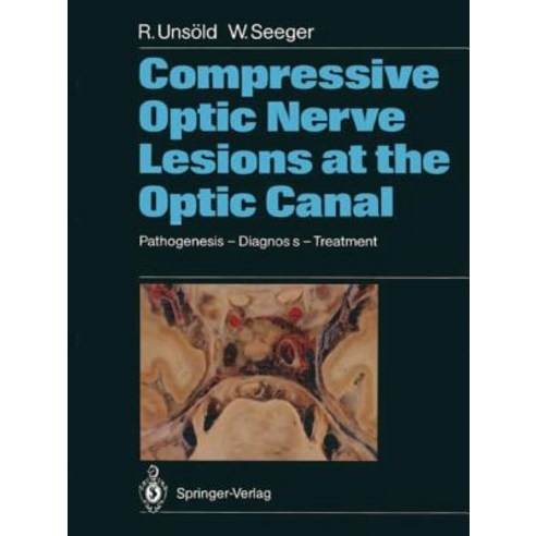 Compressive Optic Nerve Lesions at the Optic Canal: Pathogenesis - Diagnosis - Treatment Paperback, Springer