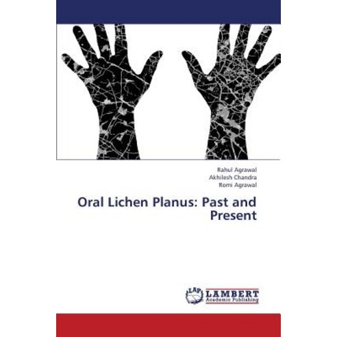 Oral Lichen Planus: Past and Present Paperback, LAP Lambert Academic Publishing