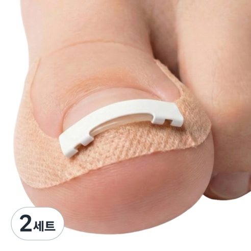 라이언문 니티놀 내성발톱 교정기, 2세트
