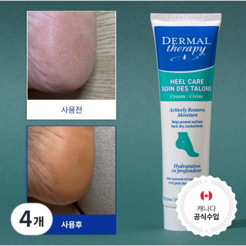 캐나다 더말테라피 데일리 고보습케어 각질제거 우레아 10% 풋크림, 90g, 4개, 1개입