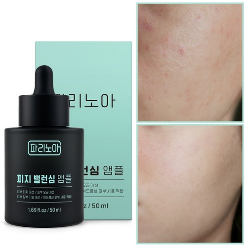 피지 연화 앰플 피부 요철 제거 좁쌀 여드름 지성피부 관리 피지 녹이는 제품 피지 분비 억제 여드름 앰플 피부 결 개선 트러블 진정 히알루론산 수분 세럼 131 앰플, 1개, 50ml