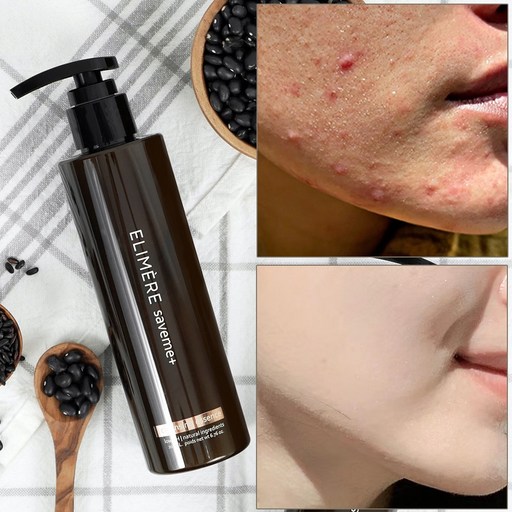 세이브미 약산성 블랙헤드 폼클렌징 200ml