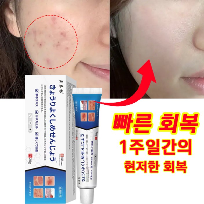 일본 히트 상품당일배송 여드름 흉터 색소침착 제거 여드름  민감피부 개선 모공 진정 피지케어 크림