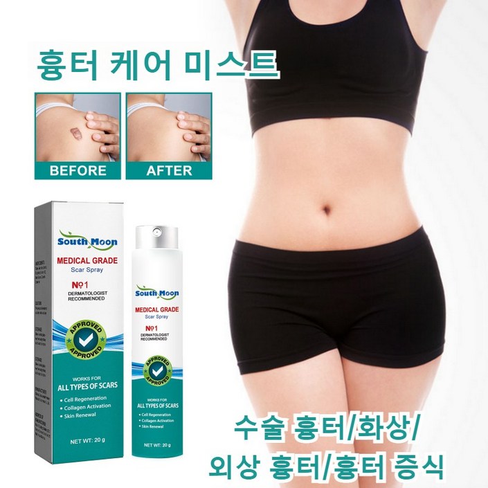 흉터 케어 미스트 수술흉터 화상물집 쌍꺼풀흉터 제왕절개흉터 흉터제거연고 재생크림 과민성 흉터흉터 증식, 5개 흉터 케어 미스트 수술흉터 화상물집 쌍꺼풀흉터 제왕절개흉터 흉터제거연고 재생크림 과민성 흉터흉터 증식, 5개