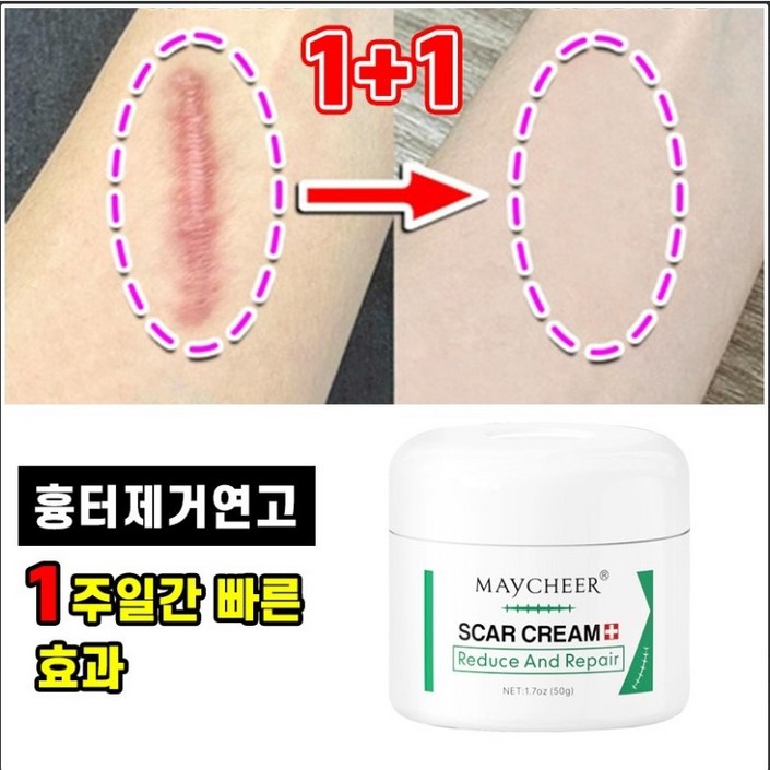 빠른배송 11 흉터 제거 연고 수술 상처 화상 피부 흉터 크림 제왕절개 흉터 관리 포장증정