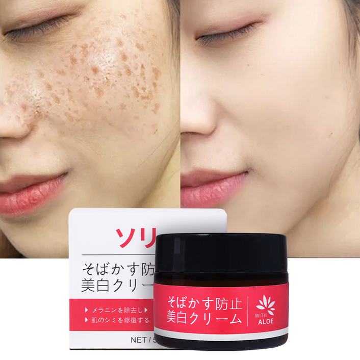 일본 기미크림 멜라노사 크림 미백 기능성 크림 기미 잡티 검버섯 얼굴 색소침착 개선 피부 화이트닝 톤업 기미 잡티 제거 크림1위, 50g, 2개