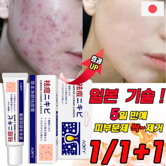 국내배송 여드름 연고 흉터 치료 제거 리페어 연고 문제피부 자국 모공 진정 피지케어 크림 국내배송 여드름 연고 흉터 치료 제거 리페어 연고 문제피부 자국 모공 진정 피지케어 크림