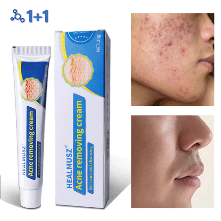 당일배송 여드름 연고 여드름 치료 스킨 배리어 리커버리 수부지 관리 크림, 2개, 20ml